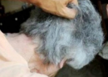 Sulmon fizikisht nënën, arrestohet