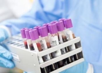 ​32 të shëruar nga COVID-19 sot në Shqipëri