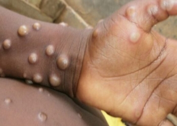 MSH –ja dhe IKSHP-ja sot mbajnë konferencë për media për lijën e majmunëve