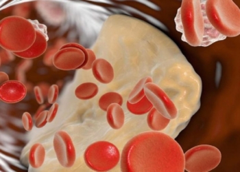 Pijet apo ushqimet me sheqer – Cilat ju shëndoshin më shumë