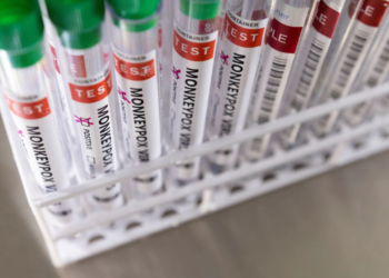 OBSH: Lia e majmunëve shqetësuese, por jo emergjencë globale