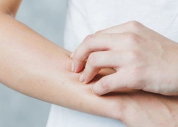 ​ Si të mbroheni prej alergjisë nga dielli