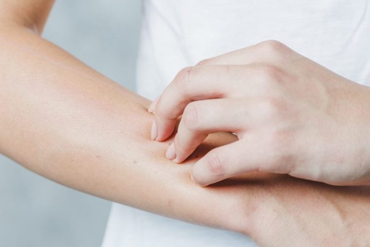  Si të mbroheni prej alergjisë nga dielli