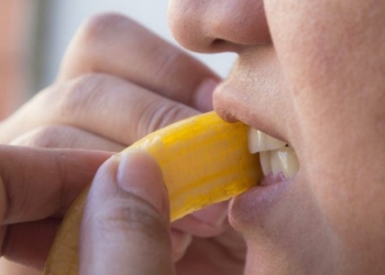 Zbardhni dhëmbët vetëm me lëvore të bananes