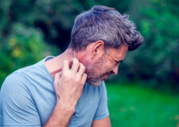 Si ta ndaloni menjëherë të kruarën nga kafshimi i mushkonjave