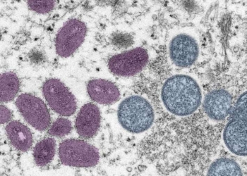 Në SHBA raportohen dy rastet e para me linë e majmunit te fëmijët