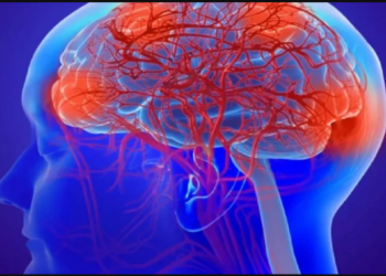 Çfarë duhet të bëni për të parandaluar demencën