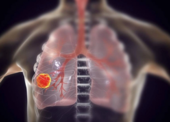 Kujdes! Këto simptoma tregojnë se keni probleme me mushkëritë