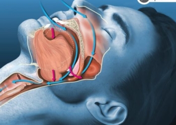 Sindroma e Apneas së Gjumit