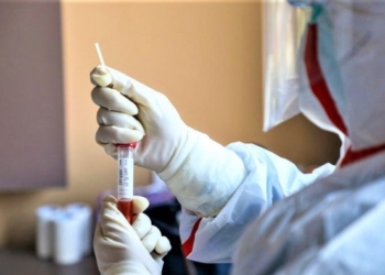 Një viktimë dhe 375 raste të reja me Covid-19 në Shqipëri