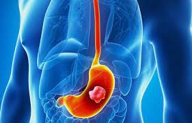 Çfarë tretë më parë stomaku