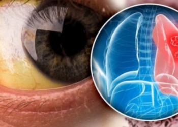 Këto simptoma tregojnë se keni probleme me mushkëritë