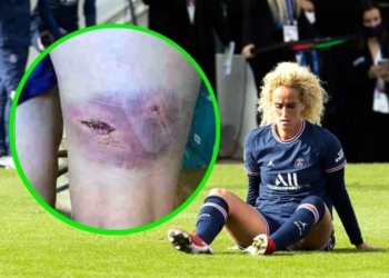 Për pak i thyen këmbët, arrestohen agresorët e sulmueses së PSG-së