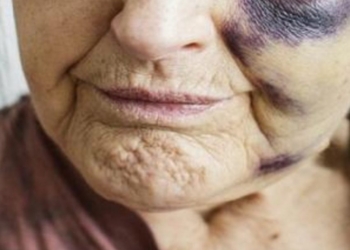 Nusja rrah vjehrrën në Fushë – Kosovë