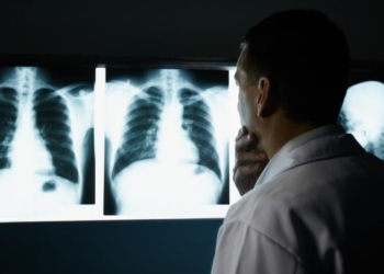 Disa mënyra natyrale për t’i pastruar mushkëritë