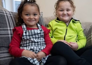 Binjakët lindën me ngjyra të ndryshme lëkure dhe janë rritur në mitra të ndara