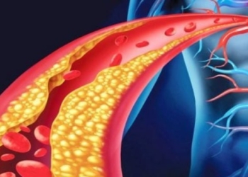 Hudhër dhe lëng portokalli për qarkullimin e gjakut