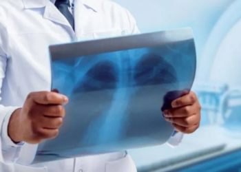 Gjashtë mënyra natyrale për t’i pastruar mushkëritë