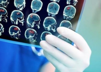 ​Pse truri ynë plaket më shpejt se zakonisht?