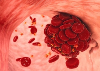 ​Mpiksjet e gjakut – njihni simptomat në kohë