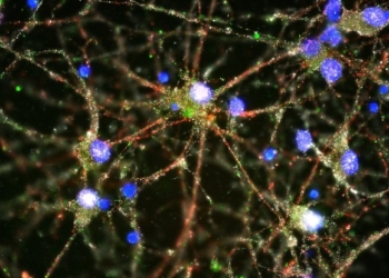 ​Shenjat e hershme të skizofrenisë