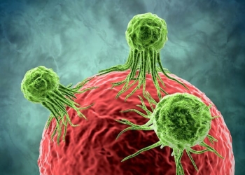 Rast unik në botë, 36-vjeçarja iu mbijeton 12 tumoreve, 5 agresivë