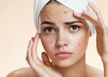 Si t’i dallojmë sëmundjet e lëkurës?