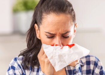 Si të ndalni rrjedhjen e gjakut nga hunda