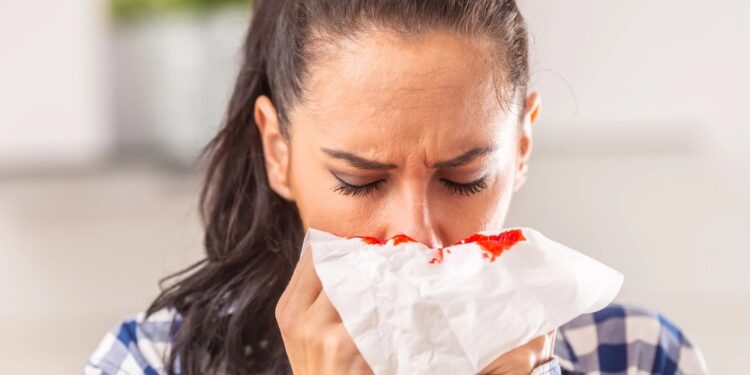 Si të ndalni rrjedhjen e gjakut nga hunda