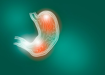 Perimet që largojnë fryrjen e stomakut