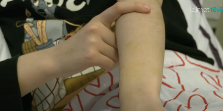 Dhunë e presion për një vit e gjysmë, G.N. rrëfen dhunën e përjetuar nga ish i dashuri E.P.