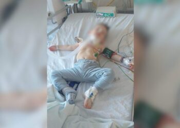 Kërkohet ndihmë për dërgimin e dy vjeçarit Nil Asllani për shërim në Turqi