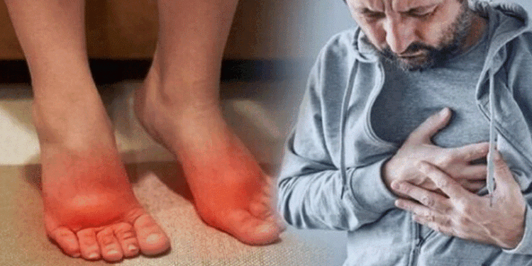 Ënjtja e këmbëve mund të sinjalizojë probleme me zemrën