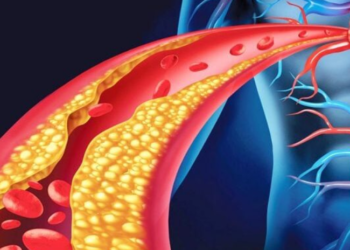Pesë ushqime që ndihmojnë në uljen e kolesterolit