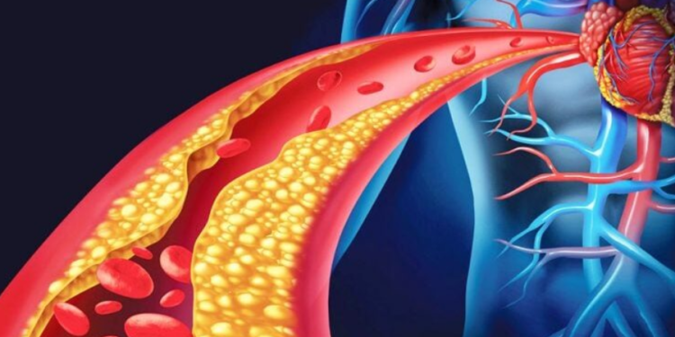 Pesë ushqime që ndihmojnë në uljen e kolesterolit