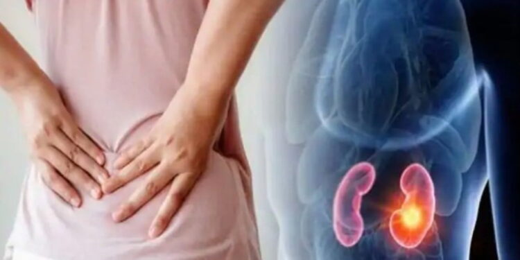 Si të kuptoni nëse keni gurë në veshka?