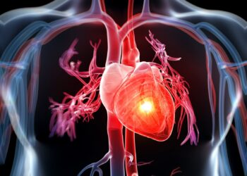 Pijet që përkeqësojnë kolesterolin dhe shëndetin e zemrës