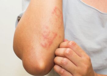 Rastet kur lëkura paralajmëron sëmundje