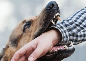 Vdes një fëmijë në Shkup, u sulmua nga qeni i fqinjit