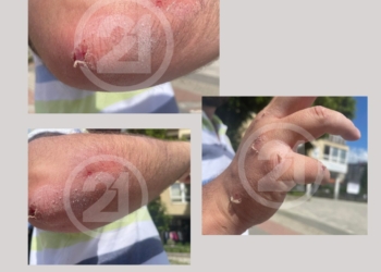 Sulmohet fizikisht ekipi i RTV21 në Veri, reagon AGK