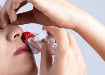 Shumica prej njerëzve e ndalojnë gabimisht gjakderdhjen nga hundët