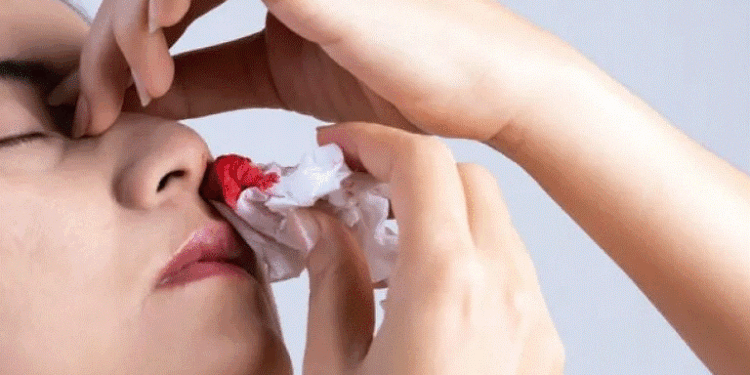 Shumica prej njerëzve e ndalojnë gabimisht gjakderdhjen nga hundët