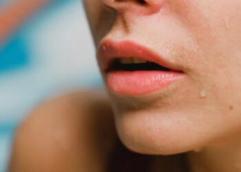 Shenjat dhe simptomat e pazakonta në gojë tregojnë se mund të keni diabet