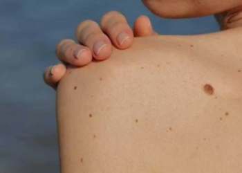 Ilaçi për humbje peshe mund të ndihmoj në vrasjen e kancerit