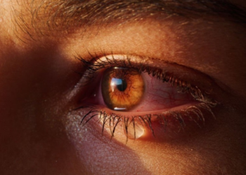 Arsyet përse ju lotojnë shpesh sytë