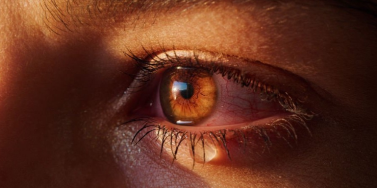 Arsyet përse ju lotojnë shpesh sytë