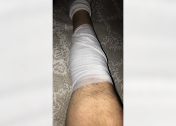 Kameramani i Tëvë1 merr tretman mjekësor pas sulmit nga protestuesit në Leposaviq