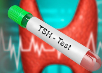Llojet e testeve të tiroides – Pse është e rëndësishme t’i bëni