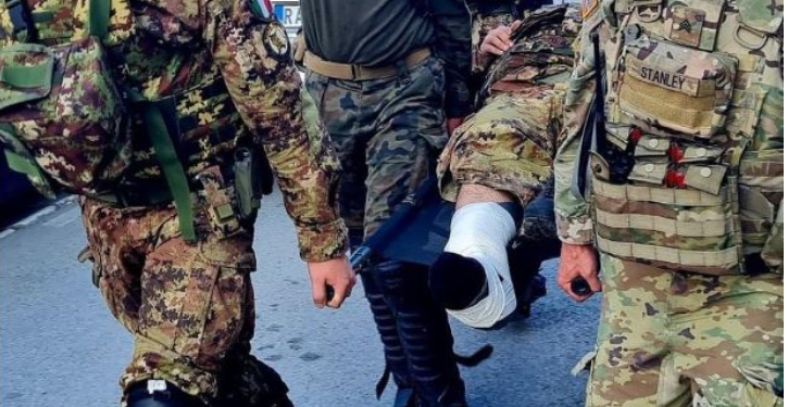 I amputohet këmba ushtarit hungarez që u lëndua nga protestuesit serbë në Zveçan