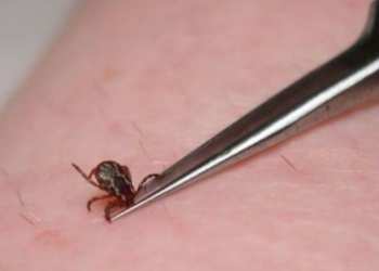 Mbi 700 pickime të rriqrave në Malishevë, 3 persona janë dërguar në QKUK